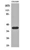 Capping Actin Protein Of Muscle Z-Line Subunit Alpha 3 antibody, orb159833, Biorbyt, Western Blot image 