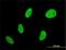 BAF Chromatin Remodeling Complex Subunit BCL7B antibody, H00009275-M01, Novus Biologicals, Immunocytochemistry image 