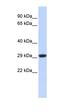 Succinate Dehydrogenase Complex Iron Sulfur Subunit B antibody, orb330526, Biorbyt, Western Blot image 