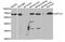 UDP-glucuronosyltransferase 1-1 antibody, MBS2524995, MyBioSource, Western Blot image 