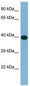 ERCC Excision Repair 6 Like 2 antibody, TA334929, Origene, Western Blot image 