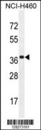 Zinc Finger CCCH-Type Containing 15 antibody, 55-476, ProSci, Western Blot image 