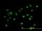 Proline-rich protein BCA3 antibody, H00056672-B01P, Novus Biologicals, Immunocytochemistry image 