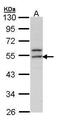 ETS Transcription Factor ERG antibody, PA5-34810, Invitrogen Antibodies, Western Blot image 