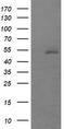 MDM4 Regulator Of P53 antibody, TA505725, Origene, Western Blot image 