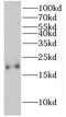 High mobility group protein HMGI-C antibody, FNab03923, FineTest, Western Blot image 