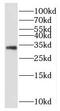 Estrogen Receptor Binding Site Associated Antigen 9 antibody, FNab07203, FineTest, Western Blot image 