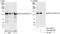 Splicing Factor 3b Subunit 2 antibody, A301-605A, Bethyl Labs, Western Blot image 