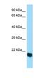 Exocyst Complex Component 3 Like 2 antibody, orb326587, Biorbyt, Western Blot image 