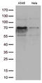 Zinc finger protein with KRAB and SCAN domains 1 antibody, M11202, Boster Biological Technology, Western Blot image 