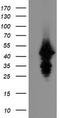 Ubiquitin Conjugating Enzyme E2 J1 antibody, TA504988S, Origene, Western Blot image 