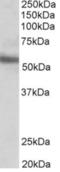 ETS Transcription Factor ERG antibody, orb19134, Biorbyt, Western Blot image 