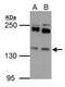 Epidermal Growth Factor Receptor Pathway Substrate 15 antibody, GTX108486, GeneTex, Western Blot image 
