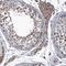 Mdm1 Nuclear Protein antibody, HPA040411, Atlas Antibodies, Immunohistochemistry frozen image 