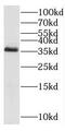 Chromosome 3 Open Reading Frame 38 antibody, FNab01108, FineTest, Western Blot image 