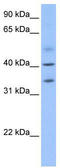 Zinc Finger CCCH-Type Containing 14 antibody, TA335325, Origene, Western Blot image 