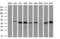 Intraflagellar Transport 57 antibody, M07455, Boster Biological Technology, Western Blot image 