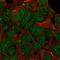 Kinase D Interacting Substrate 220 antibody, HPA014790, Atlas Antibodies, Immunofluorescence image 