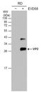 Enterovirus antibody, GTX132314, GeneTex, Western Blot image 