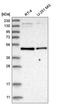 Solute carrier family 2, facilitated glucose transporter member 2 antibody, HPA028998, Atlas Antibodies, Western Blot image 