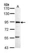 Phosphofructokinase, Muscle antibody, PA5-22172, Invitrogen Antibodies, Western Blot image 