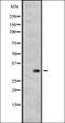 Retinal G Protein Coupled Receptor antibody, orb335668, Biorbyt, Western Blot image 
