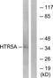 5-Hydroxytryptamine Receptor 5A antibody, TA314045, Origene, Western Blot image 