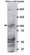 Ubiquitin Specific Peptidase 28 antibody, orb100097, Biorbyt, Western Blot image 