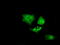 Bruton Tyrosine Kinase antibody, TA501090, Origene, Immunofluorescence image 