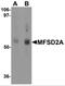 Major Facilitator Superfamily Domain Containing 2A antibody, NBP2-81929, Novus Biologicals, Western Blot image 