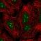 Zinc finger protein GLI2 antibody, HPA074275, Atlas Antibodies, Immunofluorescence image 