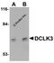 Doublecortin Like Kinase 3 antibody, 5637, ProSci, Western Blot image 