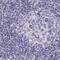 Endonuclease, Poly(U) Specific antibody, NBP2-55877, Novus Biologicals, Immunohistochemistry paraffin image 