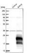 Survivin antibody, NBP2-48494, Novus Biologicals, Western Blot image 