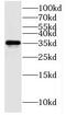3-Hydroxyisobutyrate Dehydrogenase antibody, FNab03855, FineTest, Western Blot image 