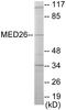 Mediator Complex Subunit 26 antibody, EKC1660, Boster Biological Technology, Western Blot image 