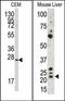 Gremlin 1, DAN Family BMP Antagonist antibody, AP13096PU-N, Origene, Western Blot image 