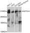 Notch Receptor 1 antibody, A7636, ABclonal Technology, Western Blot image 