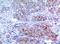 Keratin 2 antibody, A05667, Boster Biological Technology, Immunohistochemistry frozen image 