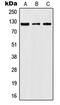 Janus Kinase 2 antibody, GTX32203, GeneTex, Western Blot image 