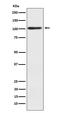Actinin Alpha 2 antibody, M03673-1, Boster Biological Technology, Western Blot image 