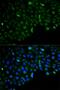 Hexokinase-2 antibody, LS-B13358, Lifespan Biosciences, Immunofluorescence image 