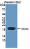 DNA Topoisomerase III Alpha antibody, LS-C712760, Lifespan Biosciences, Western Blot image 