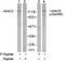 Histone deacetylase 5 antibody, TA310004, Origene, Western Blot image 
