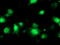 Bifunctional coenzyme A synthase antibody, M09138, Boster Biological Technology, Immunofluorescence image 