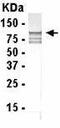 AP2M1 antibody, GTX13992, GeneTex, Western Blot image 