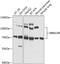 RNA Binding Motif Protein 15B antibody, A11484, Boster Biological Technology, Western Blot image 