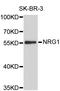 NRG-1 antibody, abx126986, Abbexa, Western Blot image 
