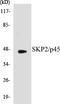 S-Phase Kinase Associated Protein 2 antibody, EKC1525, Boster Biological Technology, Western Blot image 