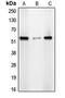 Chromodomain Y Like 2 antibody, LS-C353626, Lifespan Biosciences, Western Blot image 
